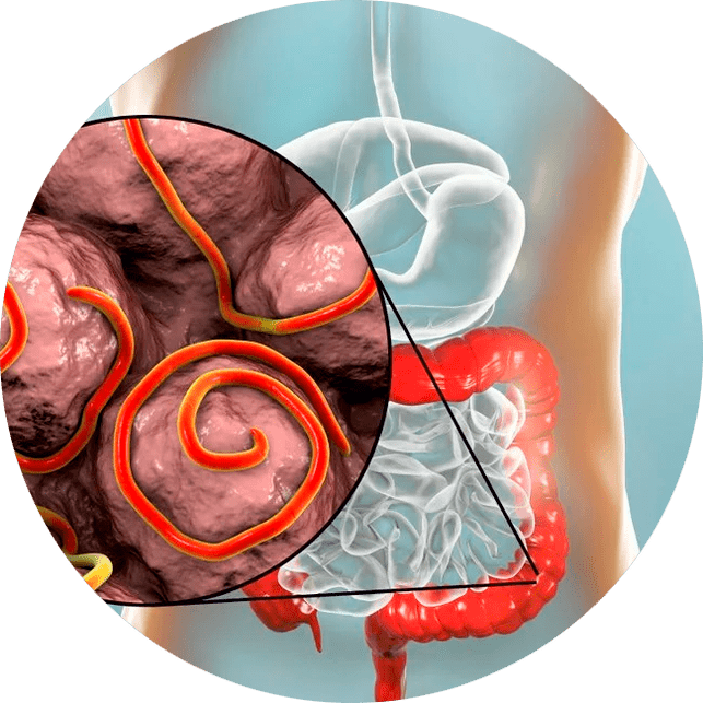 Magen-Darm-Trakt und Parasiten