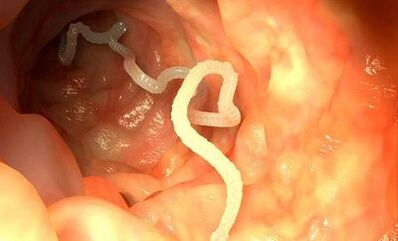 Ursachen von Parasiten im menschlichen Körper