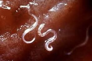 Parasiten im menschlichen Körper