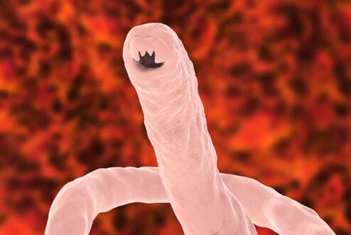parasitärer Wurm des Menschen